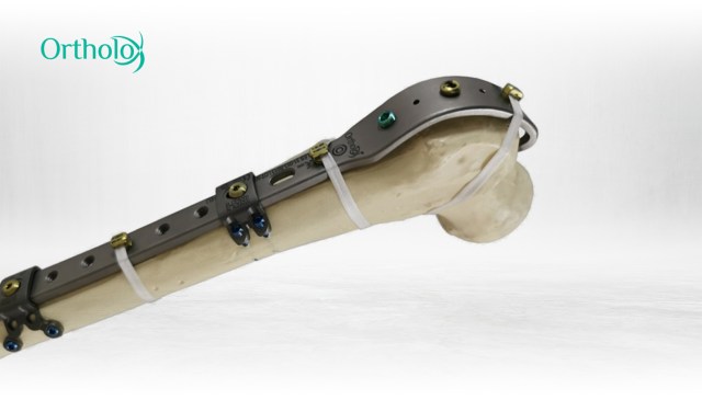 soporte5